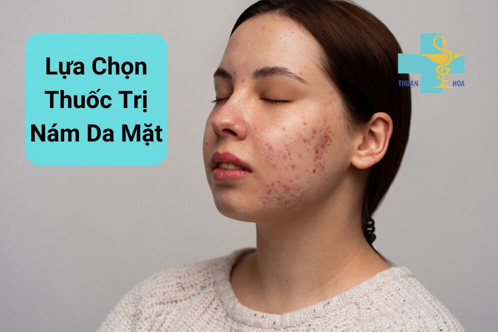 thuốc trị nám da mặt