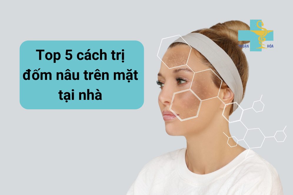 cách điều trị đốm nâu trên mặt tại nhà 