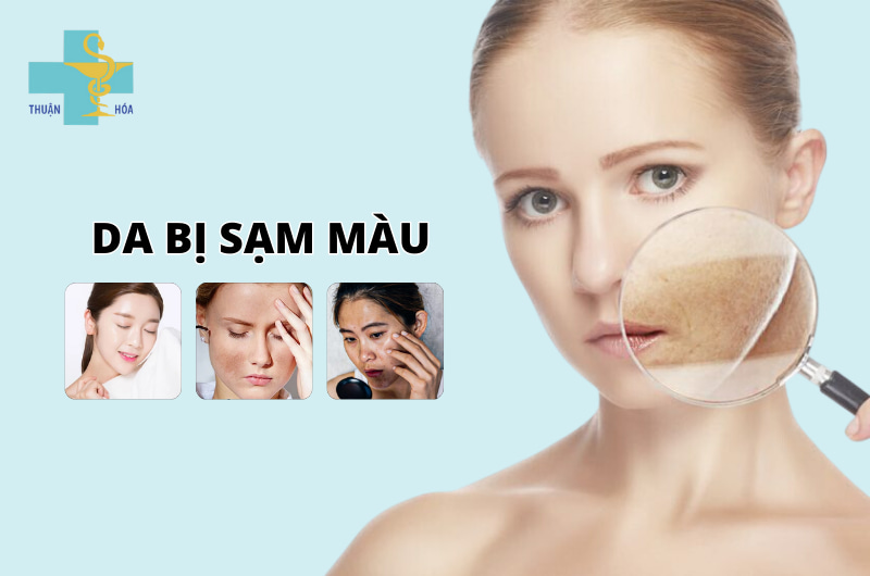 da bị sạm màu