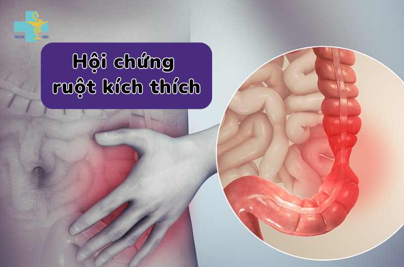 Triệu chứng của hội chứng ruột kích thích