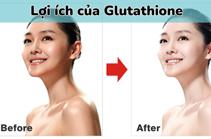 Gluthatione trắng da toàn thân