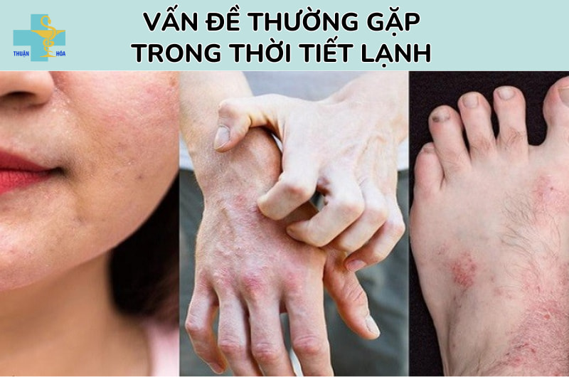 vấn đề của da trong thời tiết lạnh