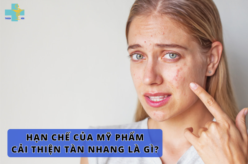 Có nên dùng mỹ phẩm cải thiện tàn nhang? Góc giải đáp chi tiết 3 Hạn chế của mỹ phẩm cải thiện tàn nhang
