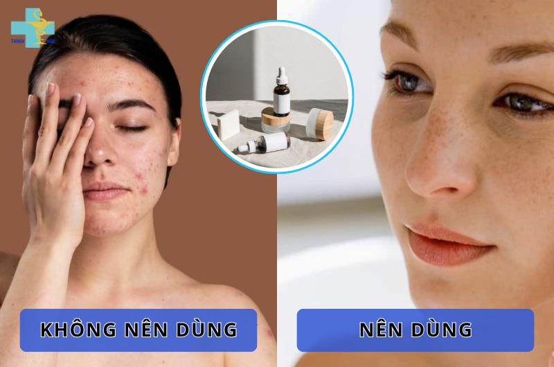 Có nên dùng mỹ phẩm cải thiện tàn nhang? Góc giải đáp chi tiết 4 sử dụng mỹ phẩm cải thiện làn da