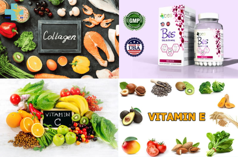 Có nên dùng mỹ phẩm cải thiện tàn nhang? Góc giải đáp chi tiết 7 cải thiện da qua việc bổ sung thực phẩm