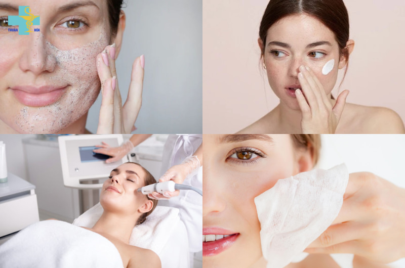 phân biệt tàn nhang và đồi mồi